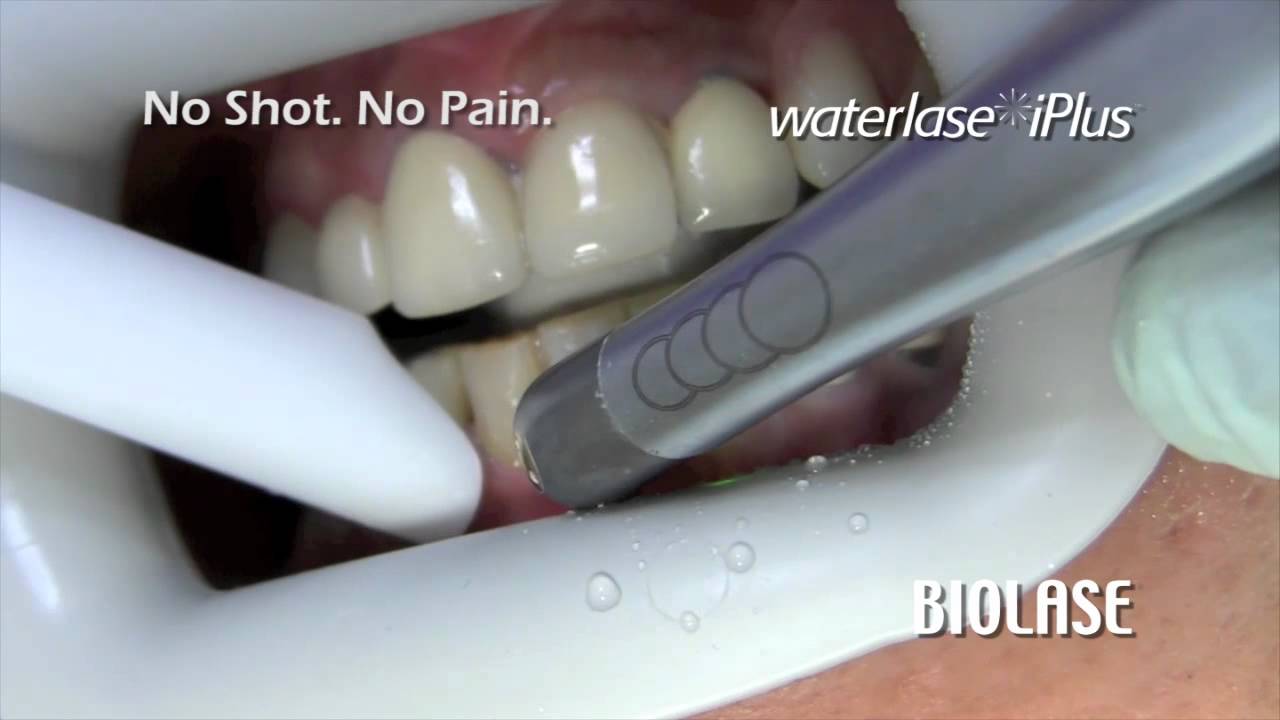 Laser Dentistry in New Haven CT